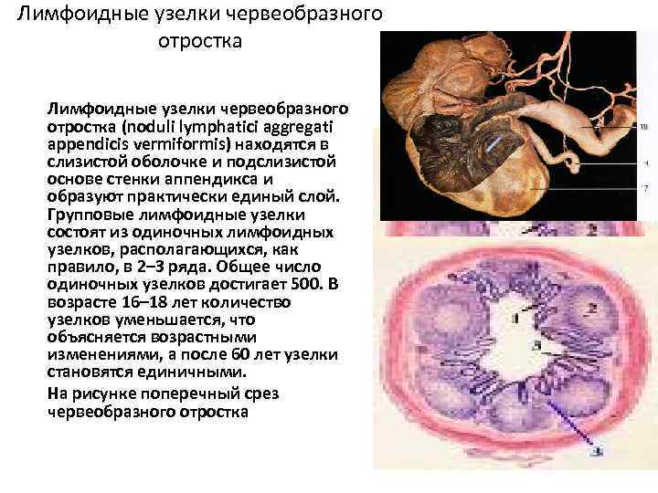 Лимфоидные узелки червеобразного отростка (noduli lymphatici aggregati appendicis vermiformis) находятся в слизистой оболочке и