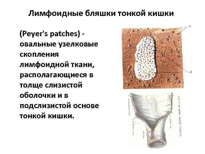 Лимфоидные бляшки тонкой кишки (Peyer's patches) - овальные узелковые скопления лимфоидной ткани, располагающиеся в