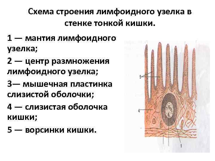 Схема строения лимфоидного узелка в стенке тонкой кишки. 1 — мантия лимфоидного узелка; 2