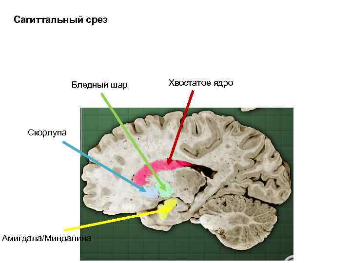 Сагиттальный срез Бледный шар Скорлупа Амигдала/Миндалина Хвостатое ядро 