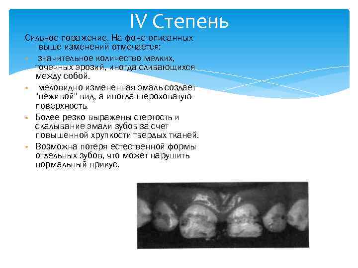 IV Степень Сильное поражение. На фоне описанных выше изменений отмечается: значительное количество мелких, точечных