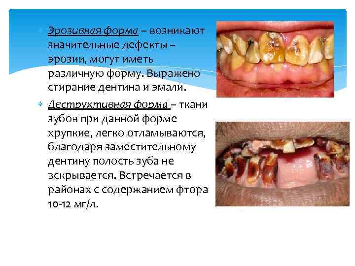  Эрозивная форма – возникают значительные дефекты – эрозии, могут иметь различную форму. Выражено