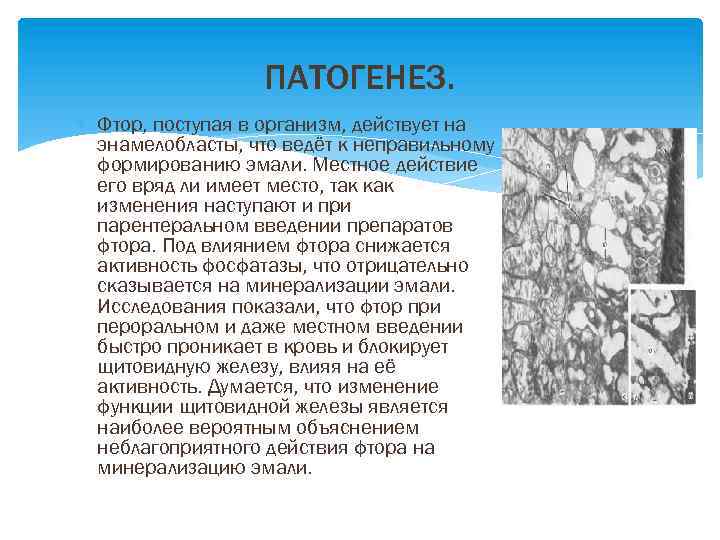 ПАТОГЕНЕЗ. Фтор, поступая в организм, действует на энамелобласты, что ведёт к неправильному формированию эмали.