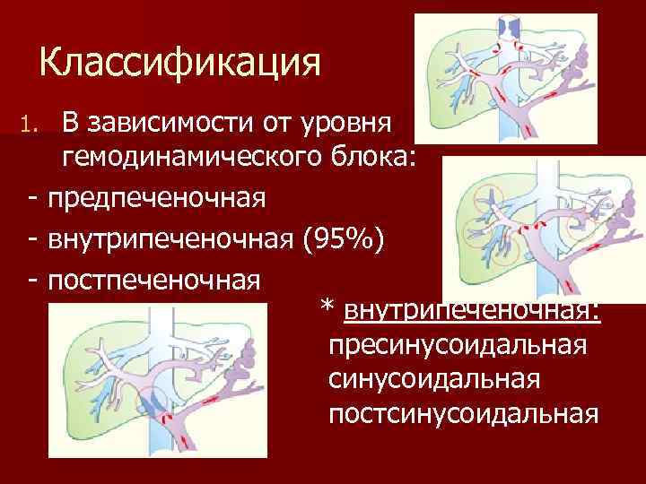 Классификация В зависимости от уровня гемодинамического блока: предпеченочная внутрипеченочная (95%) постпеченочная * внутрипеченочная: пресинусоидальная