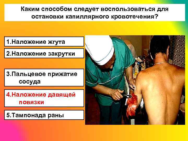Каким способом следует воспользоваться для остановки капиллярного кровотечения? 1. Наложение жгута 2. Наложение закрутки