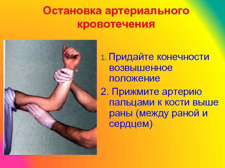 Остановка артериального кровотечения 1. Придайте конечности возвышенное положение 2. Прижмите артерию пальцами к кости
