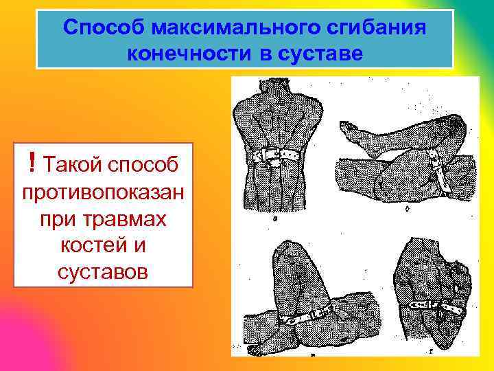 Способ максимального сгибания конечности в суставе ! Такой способ противопоказан при травмах костей и