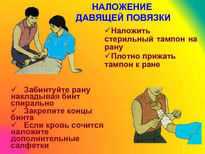 НАЛОЖЕНИЕ ДАВЯЩЕЙ ПОВЯЗКИ üНаложить стерильный тампон на рану üПлотно прижать тампон к ране ü