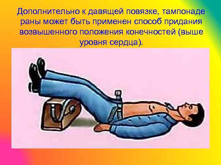 Дополнительно к давящей повязке, тампонаде раны может быть применен способ придания возвышенного положения конечностей