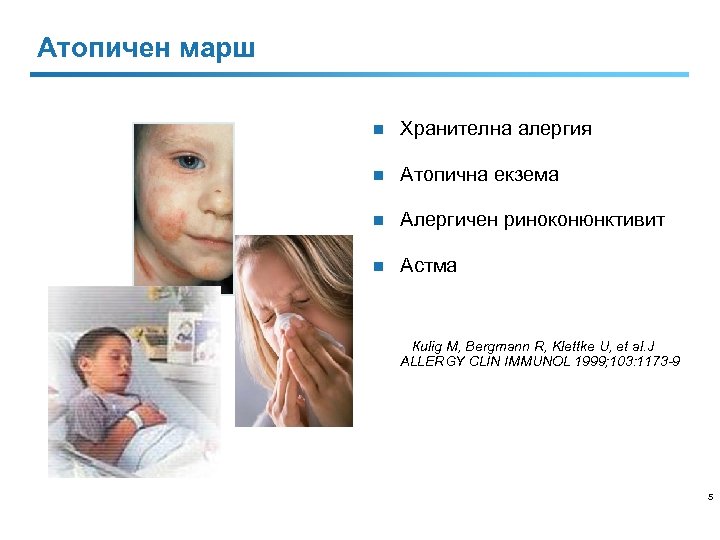 Атопичен марш n Хранителна алергия n Атопична екзема n Алергичен риноконюнктивит n Астма Кulig