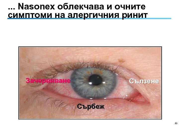 . . . Nasonex облекчава и очните симптоми на алергичния ринит Зачервяване Сълзене Сърбеж