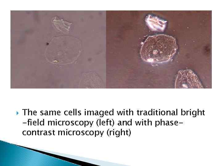 Phase Contrast Microscope Prepared Alibekova Alina The 9096