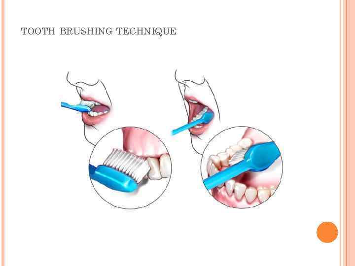 TOOTH BRUSHING TECHNIQUE 