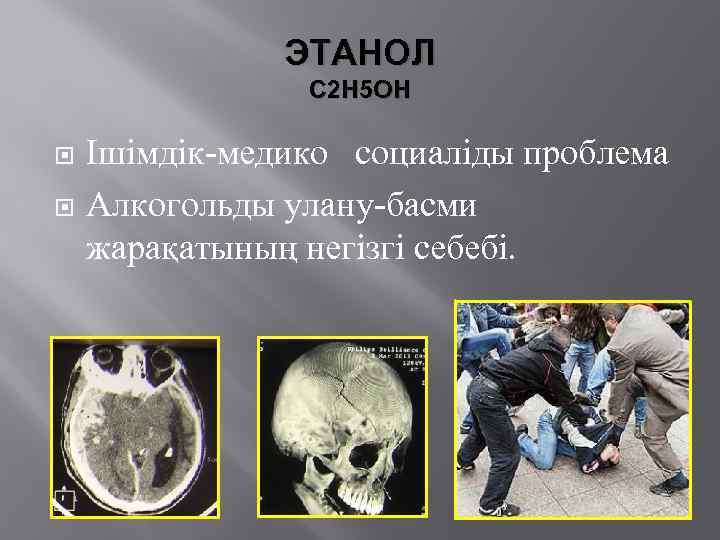 ЭТАНОЛ С 2 Н 5 ОН Ішімдік-медико социаліды проблема Алкогольды улану-басми жарақатының негізгі себебі.