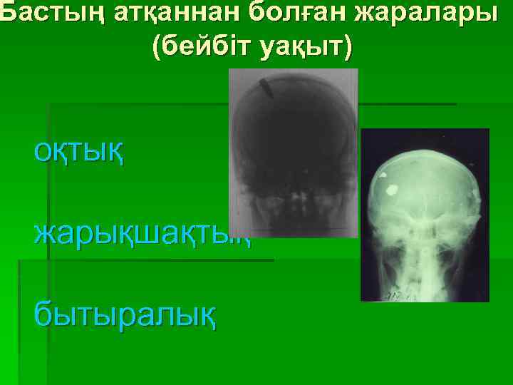 Бастың атқаннан болған жаралары (бейбіт уақыт) оқтық жарықшақтық бытыралық 