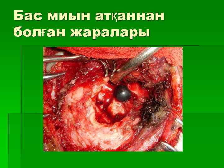 Бас миын атқаннан болған жаралары 