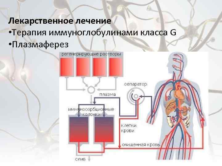 Лекарственное лечение • Терапия иммуноглобулинами класса G • Плазмаферез 