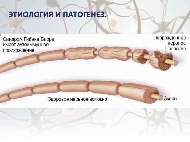 ЭТИОЛОГИЯ И ПАТОГЕНЕЗ. 