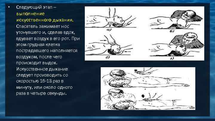  • Следующий этап – выполнение искусственного дыхания. Спасатель зажимает нос утонувшего и, сделав