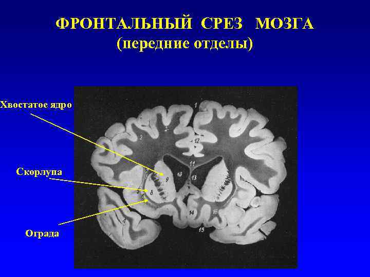 Фронтальный срез