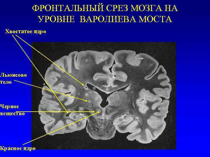 Фронтальный срез