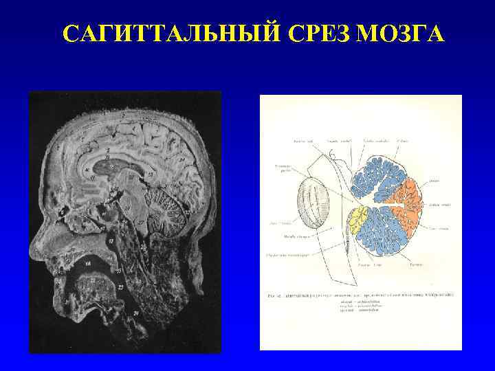 Схему развития головного мозга человека фронтальный и сагиттальный разрезы