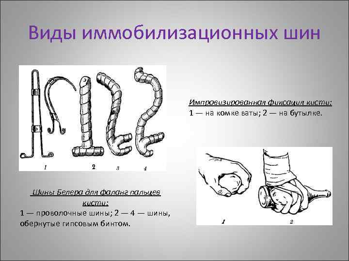 Виды иммобилизационных шин Импровизированная фиксация кисти: 1 — на комке ваты; 2 — на