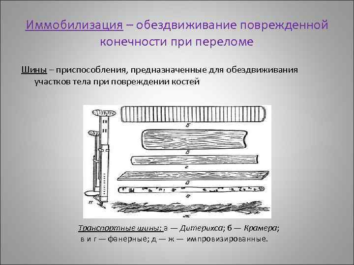 Иммобилизация – обездвиживание поврежденной конечности при переломе Шины – приспособления, предназначенные для обездвиживания участков