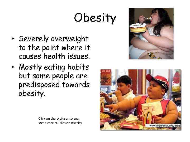 Obesity • Severely overweight to the point where it causes health issues. • Mostly