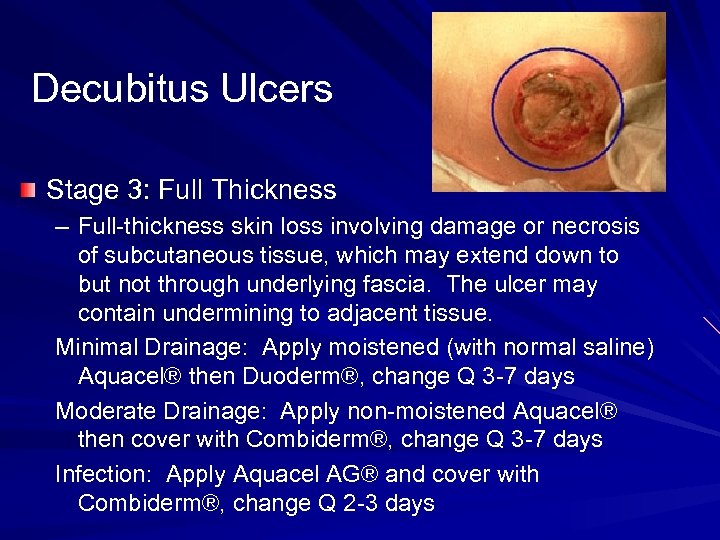 Decubitus Ulcers Stage 3: Full Thickness – Full-thickness skin loss involving damage or necrosis