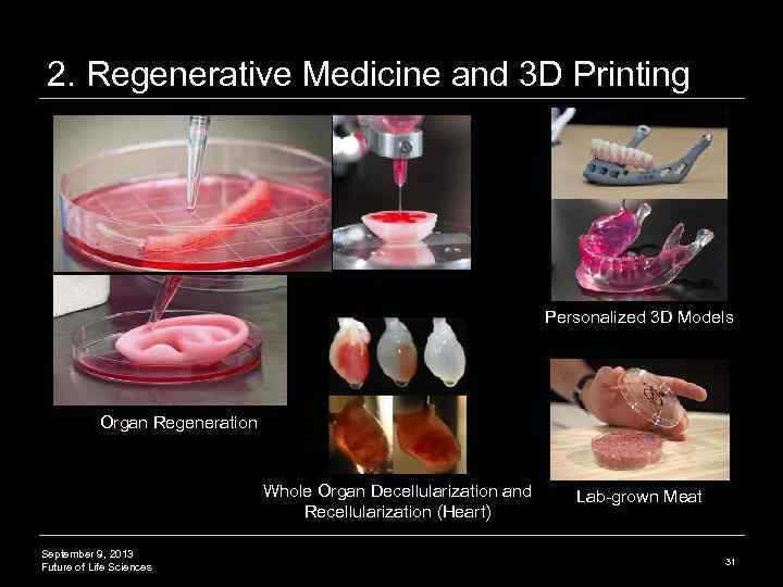 2. Regenerative Medicine and 3 D Printing Personalized 3 D Models Organ Regeneration Whole