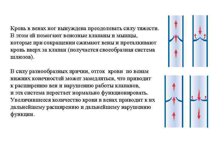 Кровь в венах ног вынуждена преодолевать силу тяжести. В этом ей помогают венозные клапаны