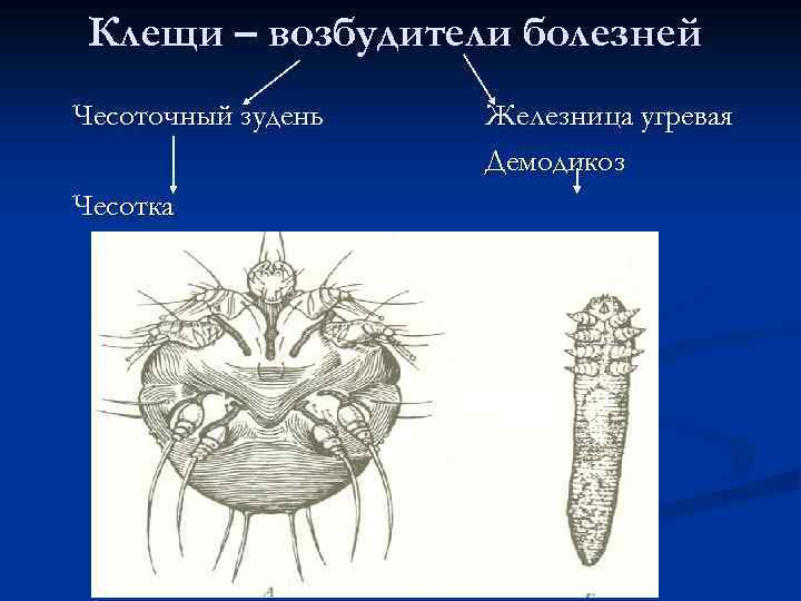 Клещи – возбудители болезней Чесоточный зудень Чесотка Железница угревая Демодикоз 