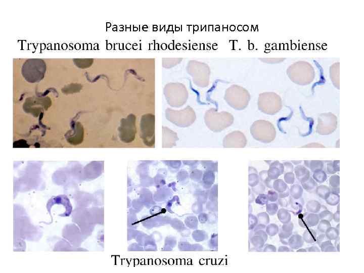 Разные виды трипаносом 