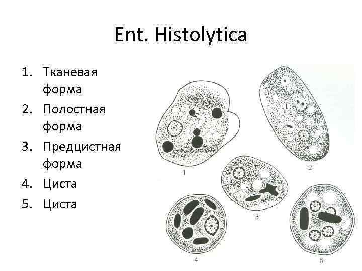 Ent. Histolytica 1. Тканевая форма 2. Полостная форма 3. Предцистная форма 4. Циста 5.