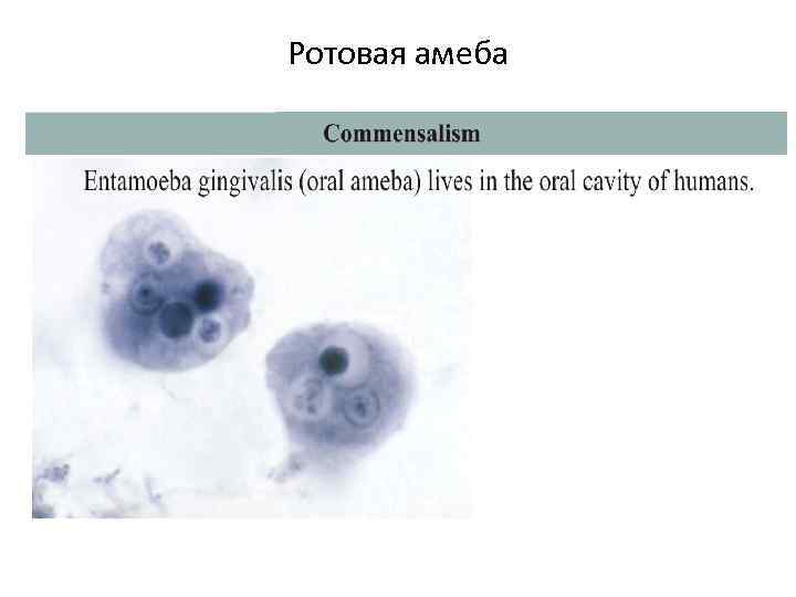 Ротовая амеба 
