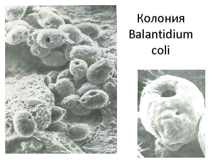 Колония Balantidium coli 