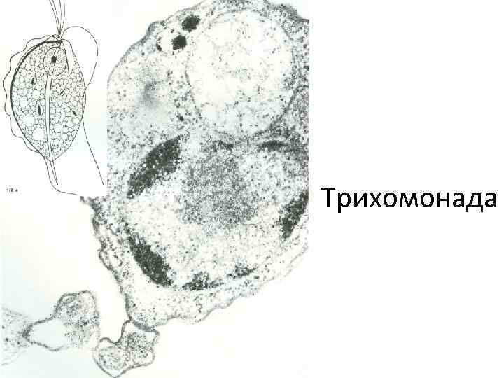 Трихомонада. Кишечная трихомонада Trichomonas Hominis. Кишечная трихомонада под микроскопом. Трихомоноз паразитология. Трихомонада паразитология.