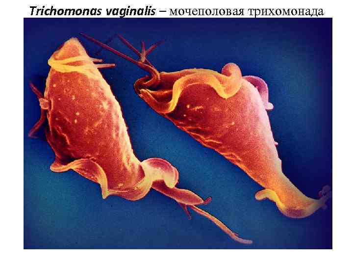 Trichomonas vaginalis – мочеполовая трихомонада 