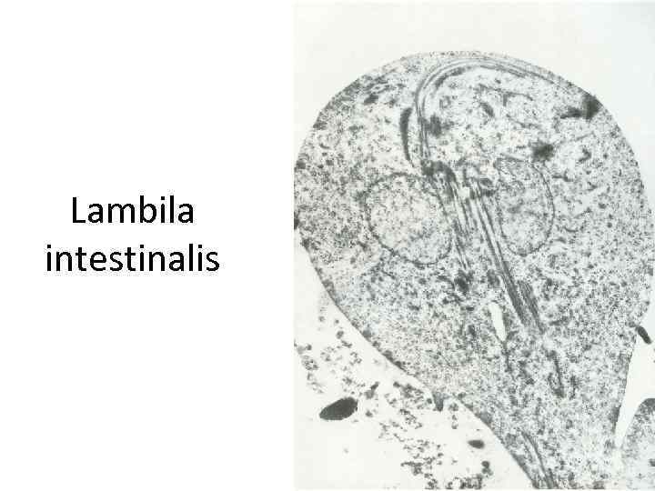 Lambila intestinalis 