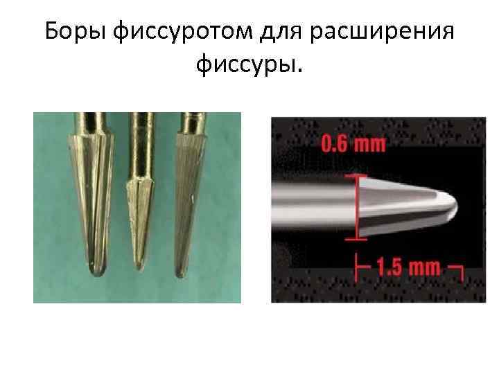 Боры фиссуротом для расширения фиссуры. 