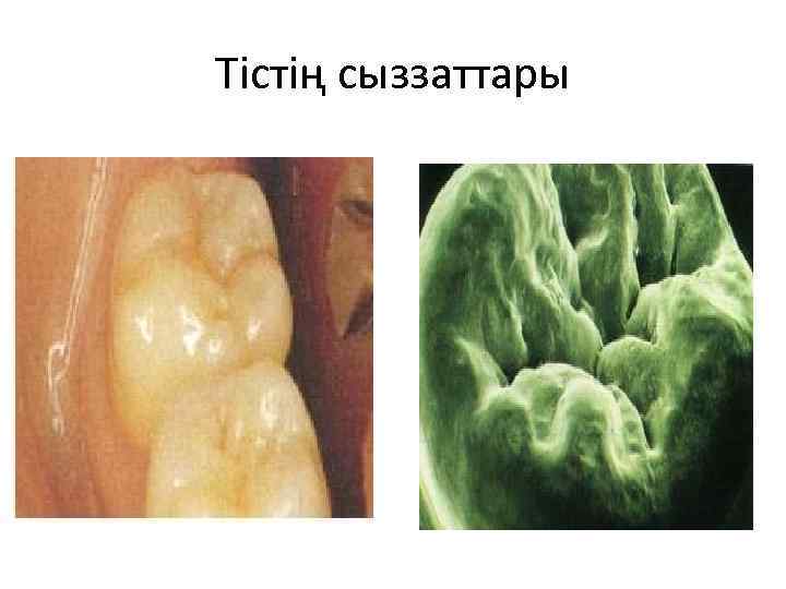 Тістің сыззаттары 