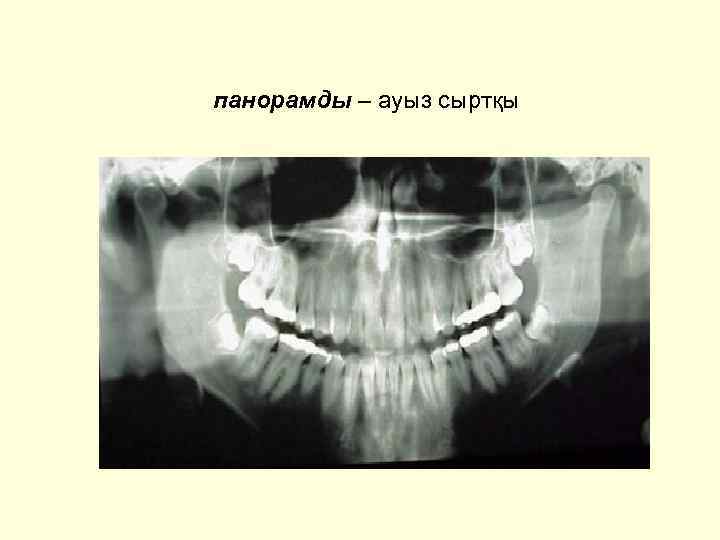 панорамды – ауыз сыртқы 