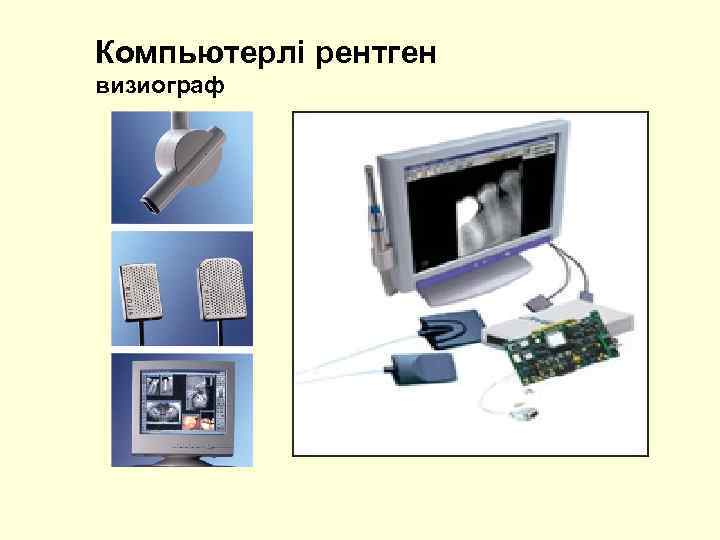 Компьютерлі рентген визиограф 