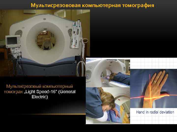 Мультисрезововая компьютерная томография Мультисрезовый компьютерный томограх „Light Speed-16” (General Electric) 