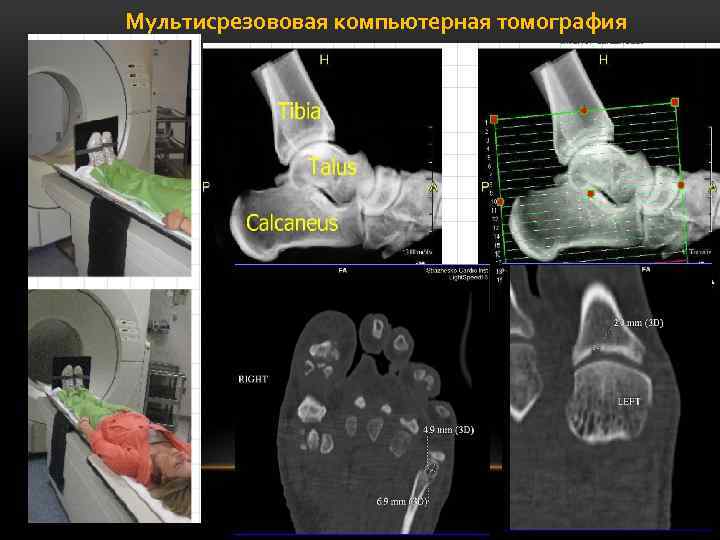 Мультисрезововая компьютерная томография 