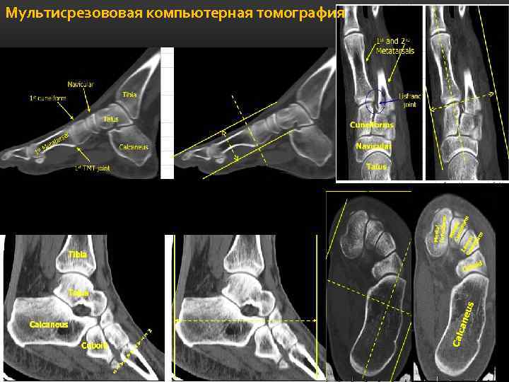 Мультисрезововая компьютерная томография 
