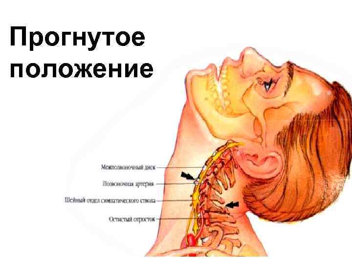 Прогнутое положение 
