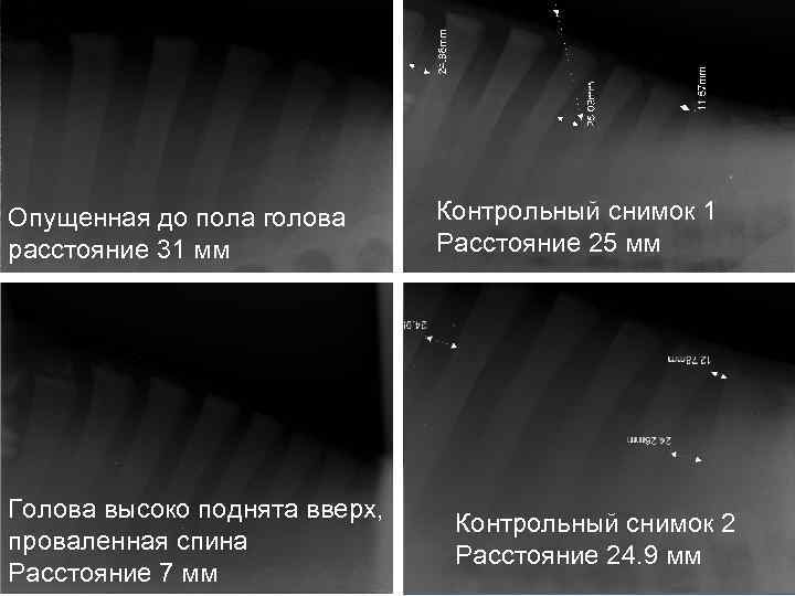Опущенная до пола голова расстояние 31 мм Голова высоко поднята вверх, проваленная спина Расстояние
