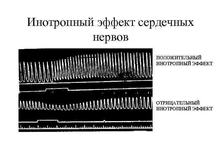 Инотропный эффект сердечных нервов ПОЛОЖИТЕЛЬНЫЙ ИНОТРОПНЫЙ ЭФФЕКТ ОТРИЦАТЕЛЬНЫЙ ИНОТРОПНЫЙ ЭФФЕКТ 
